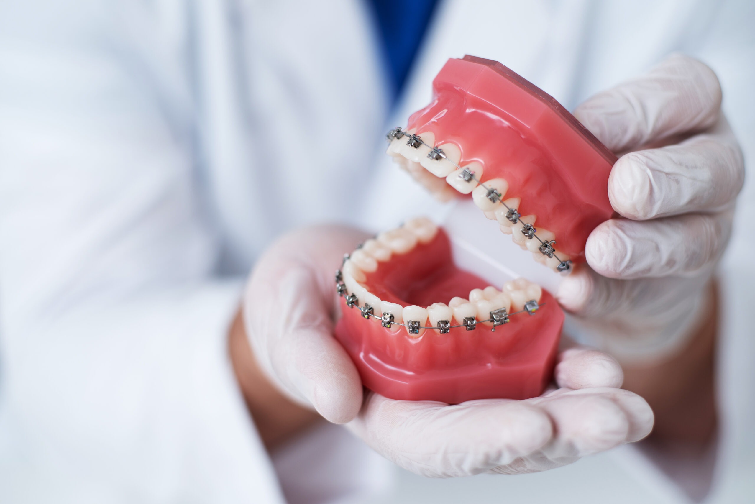 The Truth About Braces: Pain and Discomfort